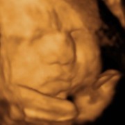 Ultrasound Photo